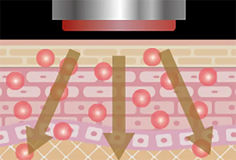 エレクトロポーション機能